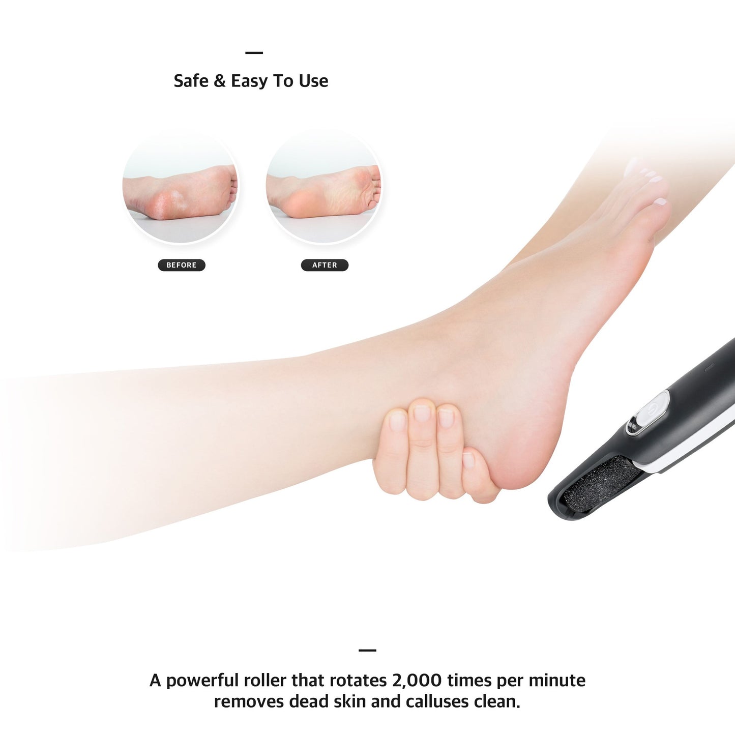 ABKO Electric Callus Remover